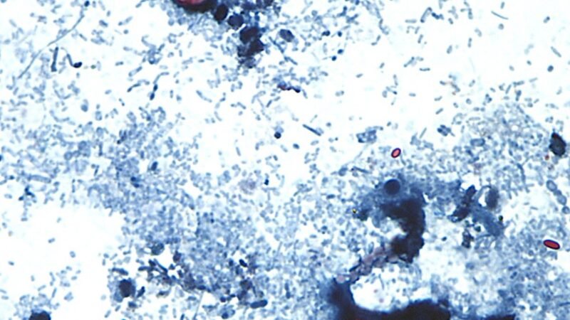 FDA encontra parasita ligado a surto de ‘diarreia explosiva’ que atingiu quase 13 mil pessoas nos EUA